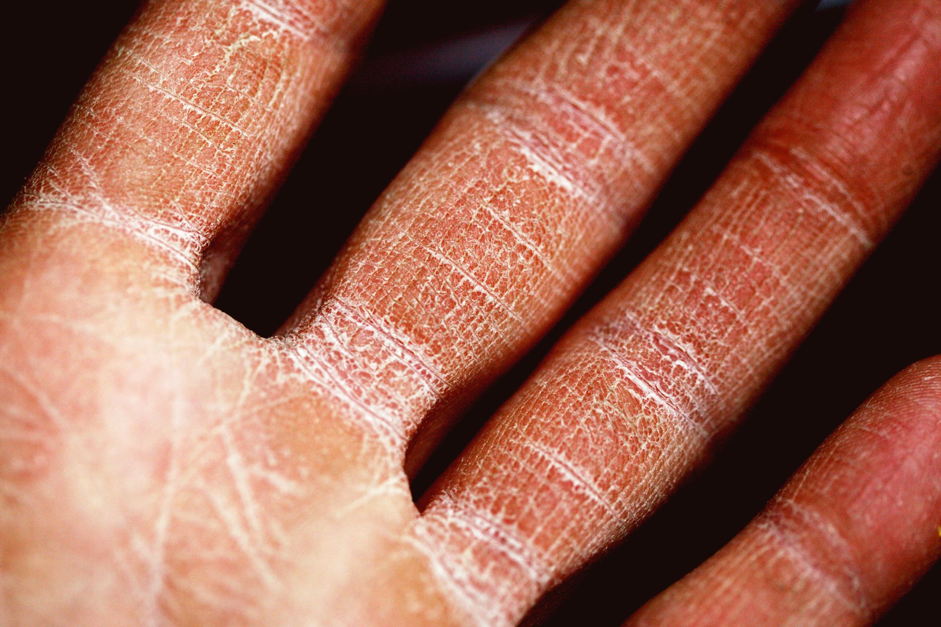 skin